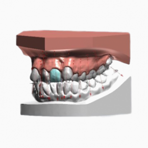 Digital orthodontics