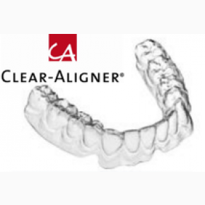 Szyny Clear Aligner ®