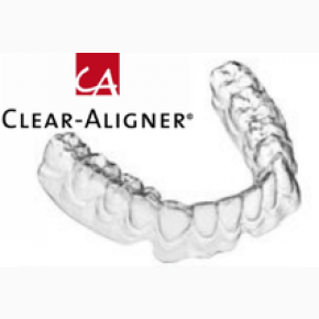 Clear Aligner® Splints System