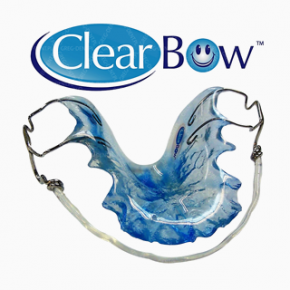 Retention appliances ClearBOW ®